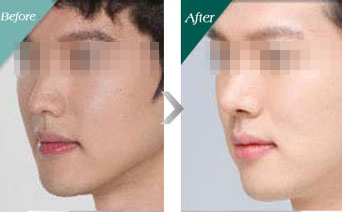 治疗男性色斑有什么方法 男士面部基础保养方法  如今的男人的外貌