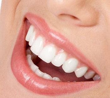 无托槽隐形牙齿矫正,悄悄变美很轻松