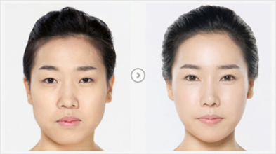 什么样的鼻子不好整 4369551667.jpg