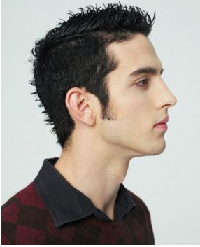 鬓角种植需要多少钱-鬓角种植-石家庄美联臣整形医院