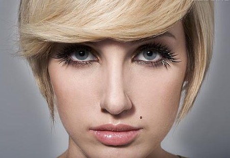 激光去痣后注意事项是什么?-注射瘦脸-石家庄