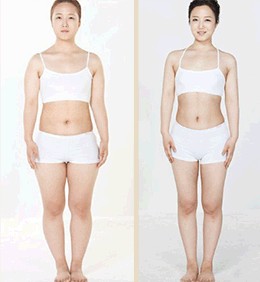 婚后<em>女性发胖</em>的<em>原因</em>是什么呢?如何更好的治疗