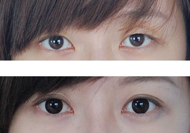 15065019920.png